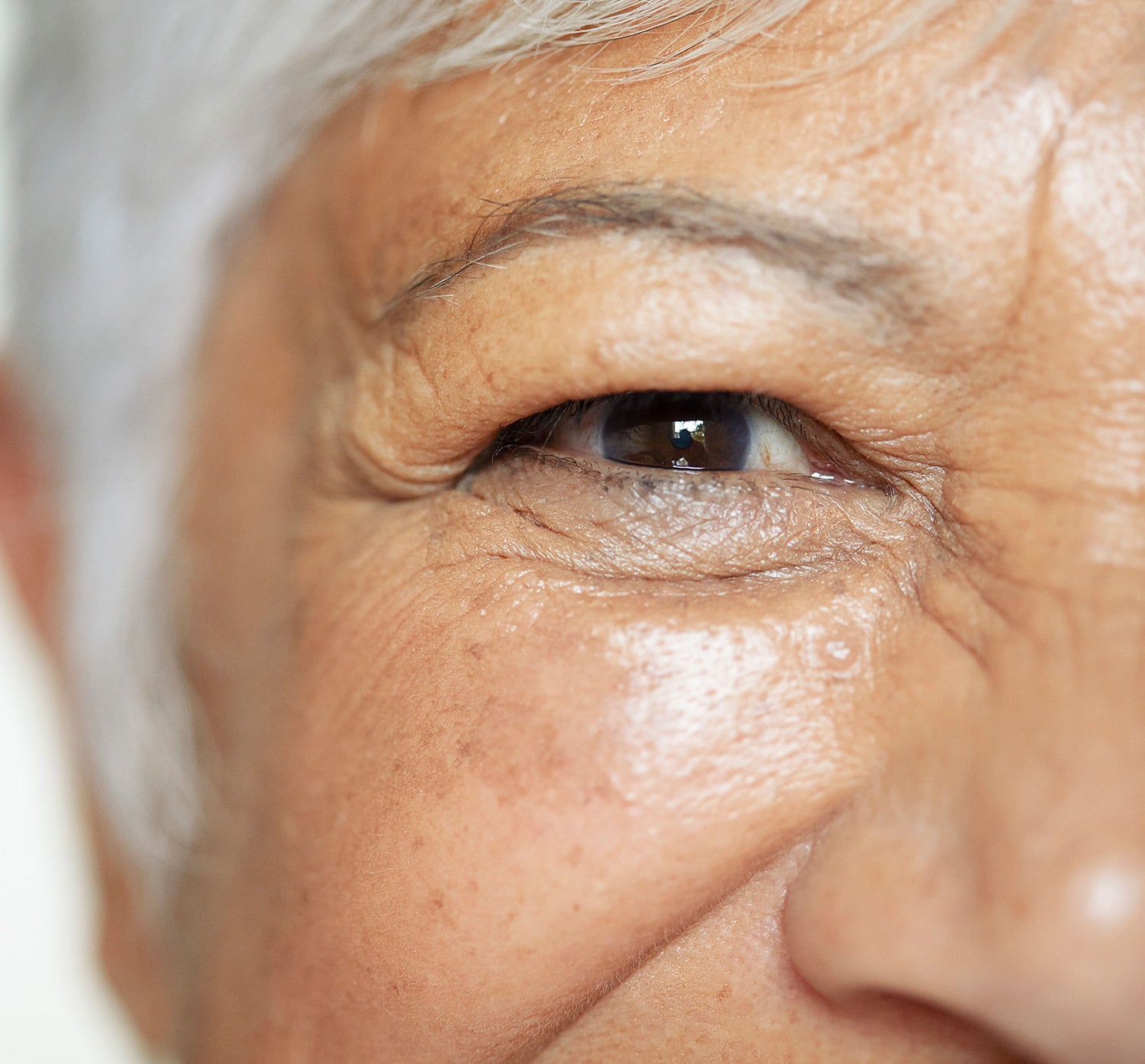 Old lady with an eye condition - Eye Press
