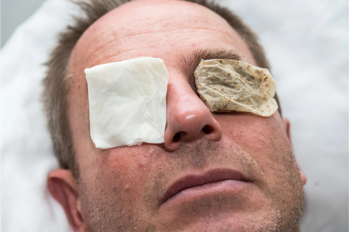 Relieving Eye Discomfort With Warm Compress Therapy